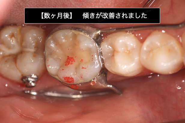 ブログ｜津市久居の歯医者｜ナカニシ歯科医院